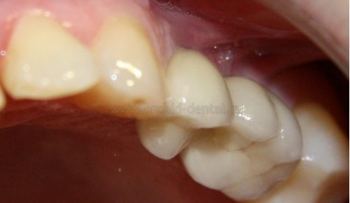 Image after