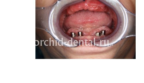 Image before