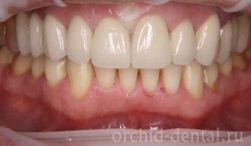 Image after