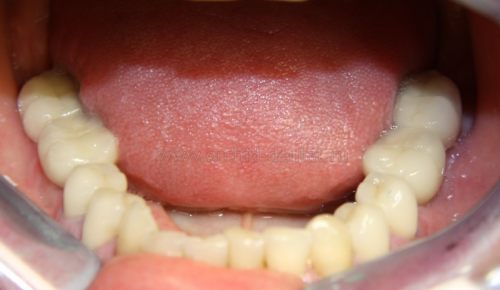 Image after