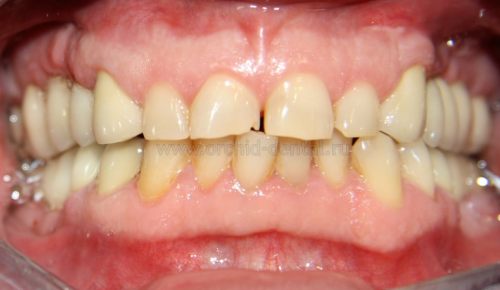 Image after
