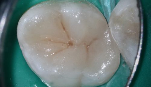 Image after