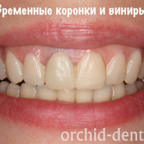 Процесс работы