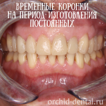 Процесс работы