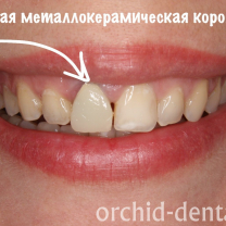 Процесс работы