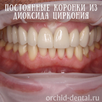 Процесс работы