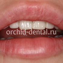 Процесс работы