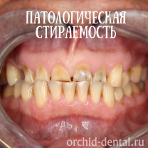 Процесс работы