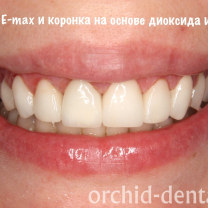 Процесс работы